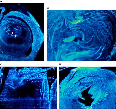 Fruit Development in Ficus carica L.: Morphological and Genetic Approaches to Fig Buds for an Evolution From Monoecy Toward Dioecy